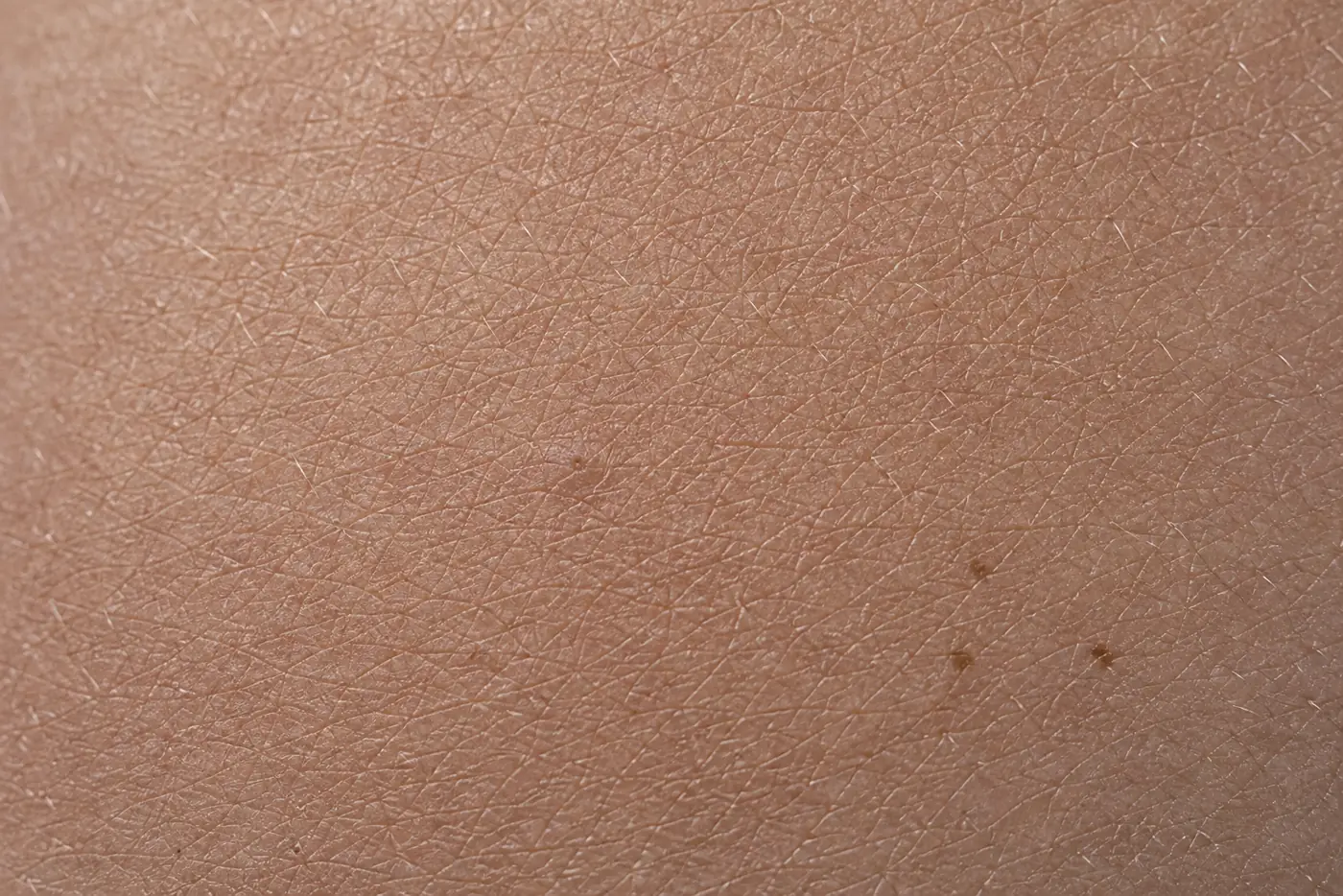 Superficie di pelle disidratata: una rete fitta di linee sottili